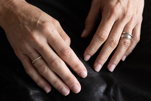 Biostimulator hand treatment