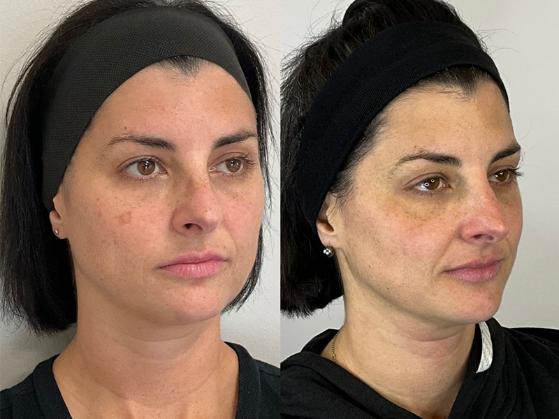 Before and after photo - MOXI