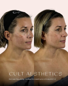 The Universal Glow before and after